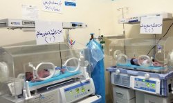 ولادة قيصرية لتوأم في مستشفى صعفان الريفي بمحافظة صنعاء
